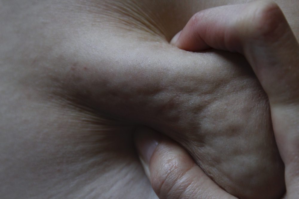 Lindsay Franke, Hate, 2019, digital photograph