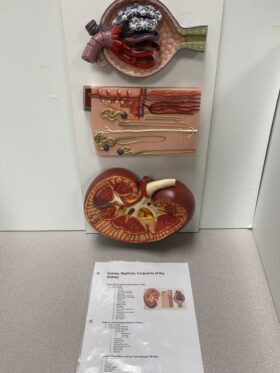 Human Kidney, Nephron, Corpuscle of the Kidney Model