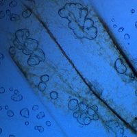 plant cells under microscope