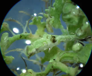 Parmeliopsis hyperopta (300x)