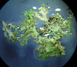 Parmeliopsis hyperopta (70x)