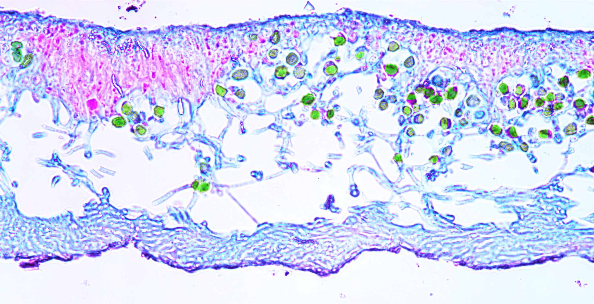 Physcia lichen (400X total magnification)
