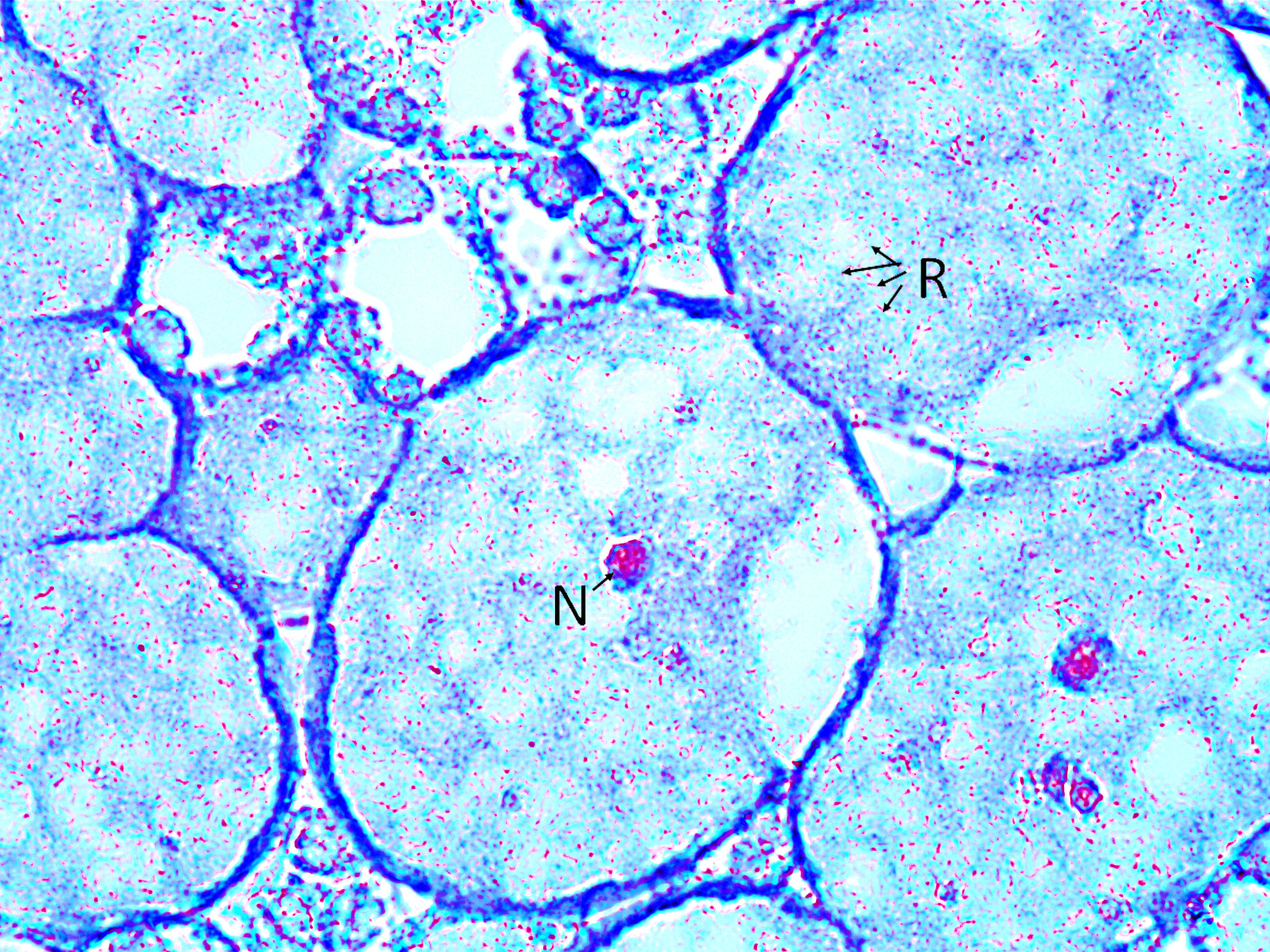 High magnification soybean root nodule cross section (1000X total magnification)