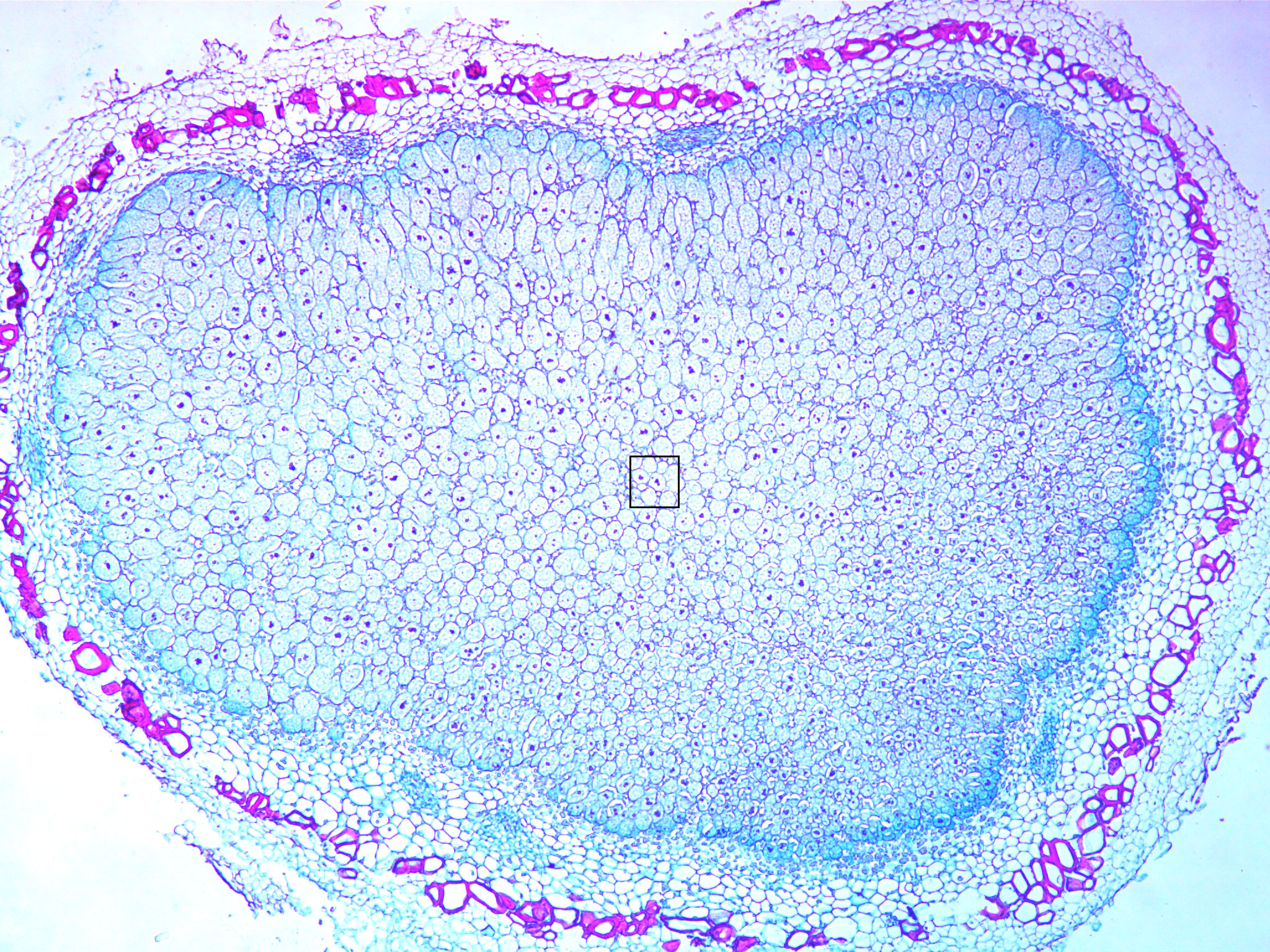 Low magnification soybean root nodule cross section (40X total magnification)